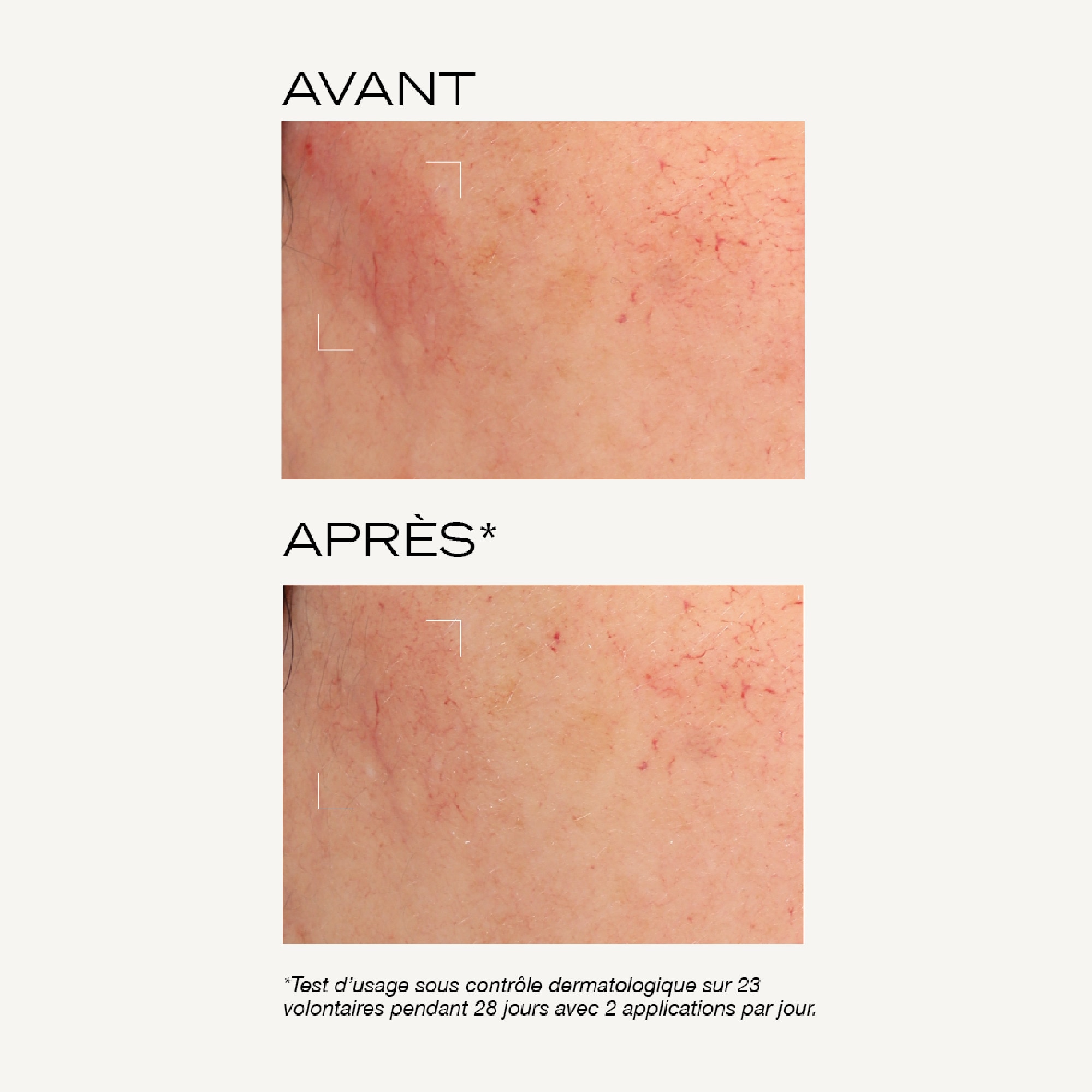 Masque peeling intense