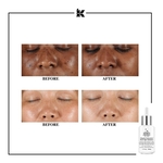 30ml KIEHLS CLEARLY CORRECTIVE™ Sérum éclat réducteur de taches  3 of 4 Sérum éclat réducteur de taches