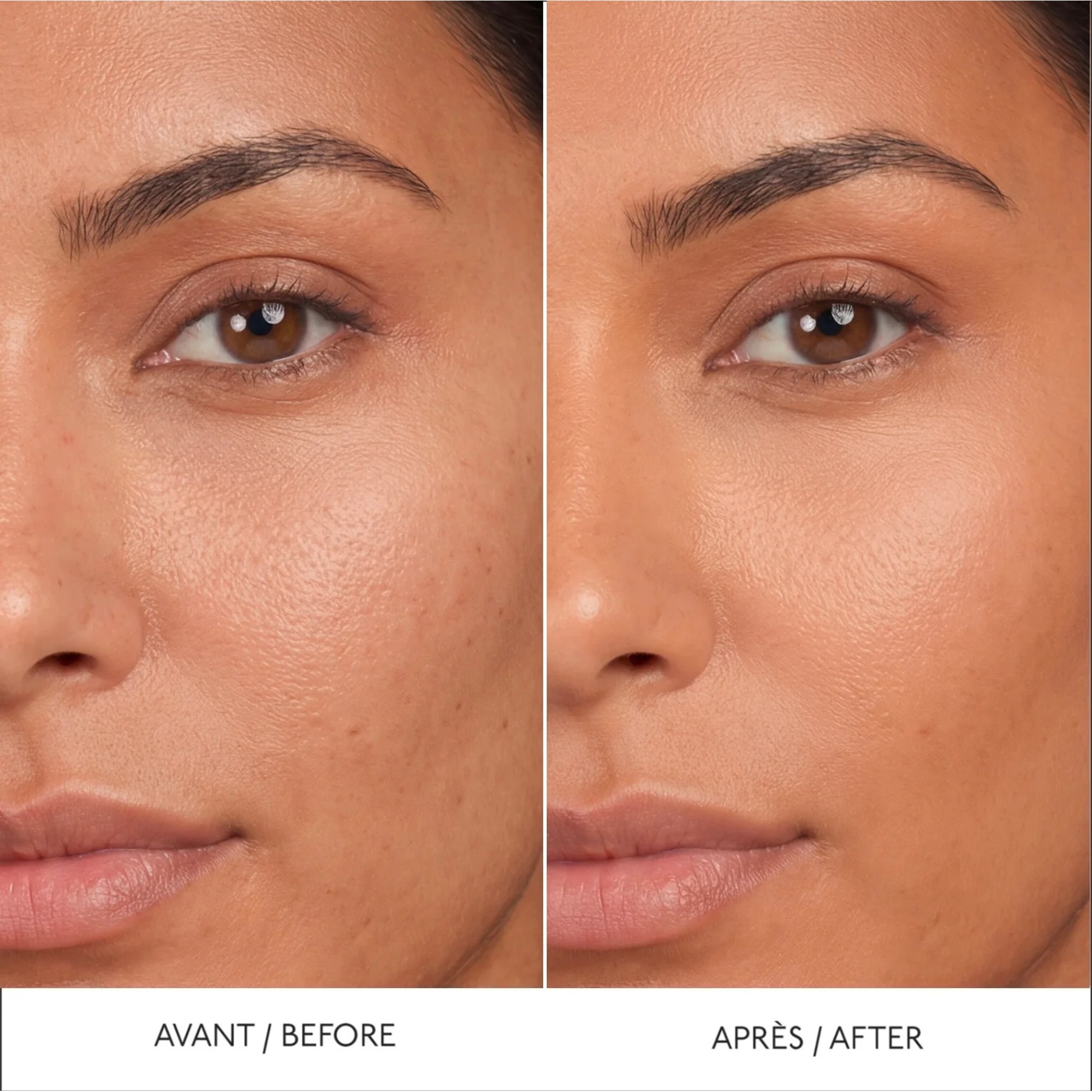 BY TERRY HYALURONIC SERUM CONCEALER Anti-cernes 1 of 3